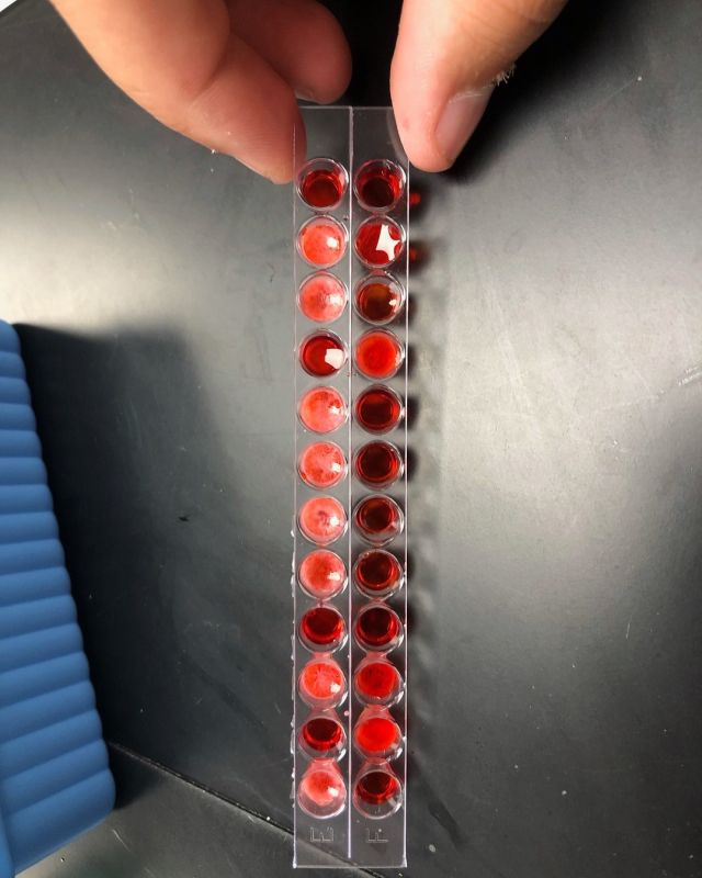 Biomedical Sciences students are determining blood types found at the crime scene this week.
#centraltechedu #centraltechbiomed #stem #scienceiscool